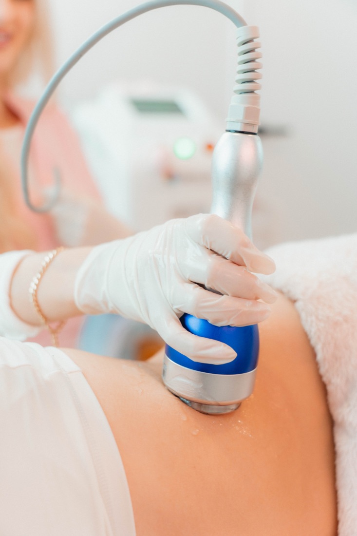 Ultrasound cavitation handpiece treating a client's body