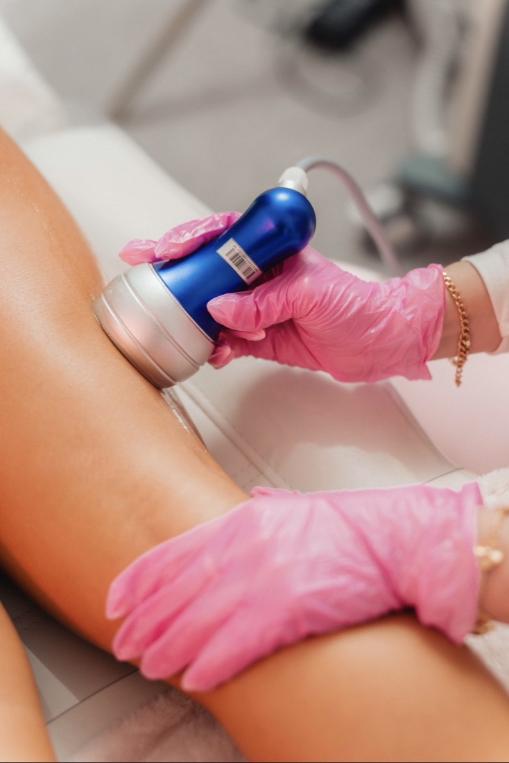 Vacuum cellulite therapy handpiece treating a client's thigh